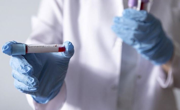 Çok konuşulacak araştırma! Koronavürüsün yararlı özelliği ortaya çıktı