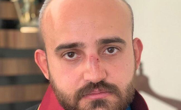 Avukata saldıran şahıslar tutuklandı