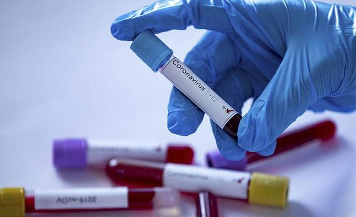 Koronavirüsle ilgili yeni durum ortaya çıktı! Hastalığı ikinci kez ve daha ağır geçirdi