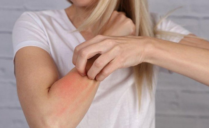 “Balığa uygulanan işlem alerji şiddetini artırır”