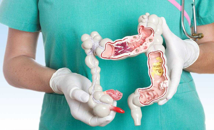 Şiddetli karın ağrısının nedeni bu hastalık olabilir!