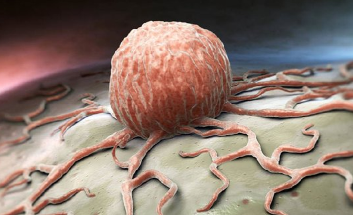 Aşırı stres kanseri tetikliyor mu? İşte cevabı...