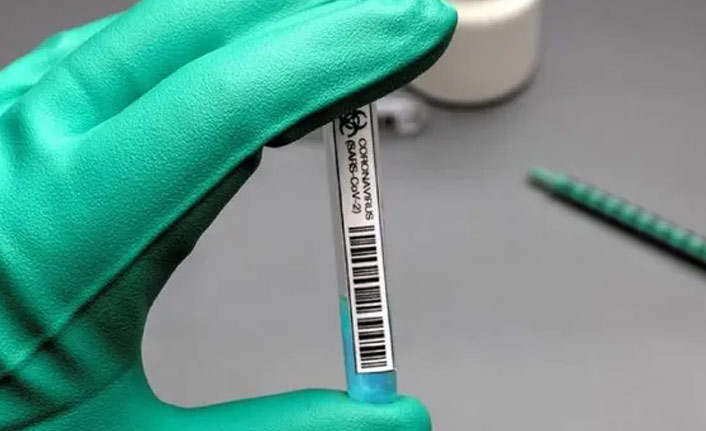 Pfizer’in koronavirüs aşısının fiyatı belli oldu!