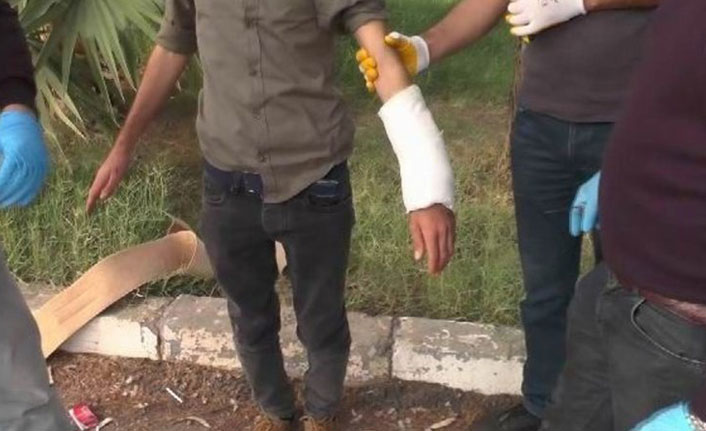 Eylem hazırlığındaydı! PKK'lının kolundaki alçıdan çıkanlar şaşırttı