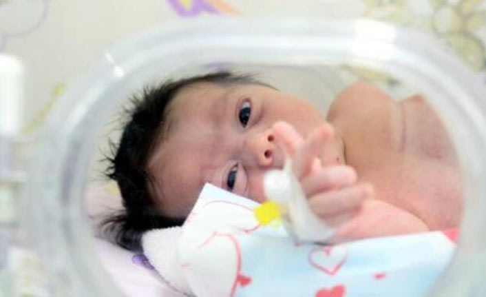 Muammer bebek tüm organları ters doğdu