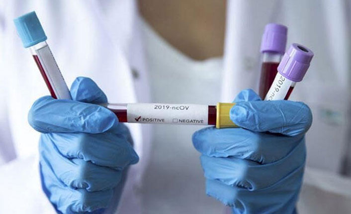 Koronavirüsün bir belirtisi daha ortaya çıktı