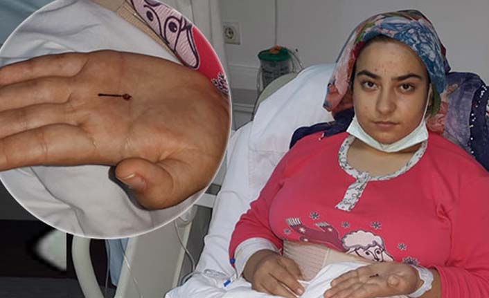 1 yaşında yuttuğu toplu iğneden 18'inde kurtuldu