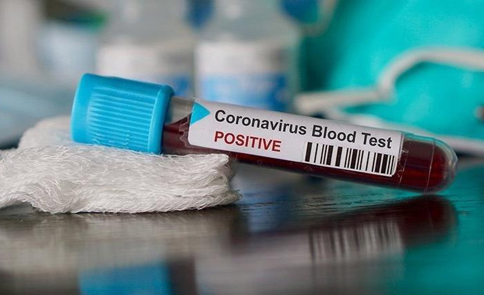 Bakan Koca açıkladı! 15 kişide mutasyonlu koronavirüs tespit edildi