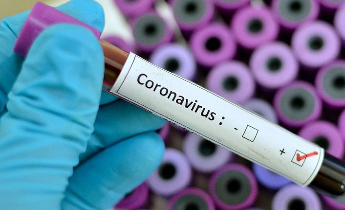 Türkiye'de son 24 saatte 6 bin 289 kişinin Kovid-19 testi pozitif çıktı, 153 kişi hayatını kaybetti