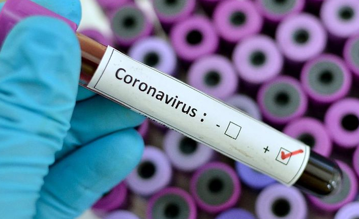 Türkiye'de son 24 saatte 5 bin 277 kişinin Kovid-19 testi pozitif çıktı, 140 kişi hayatını kaybetti