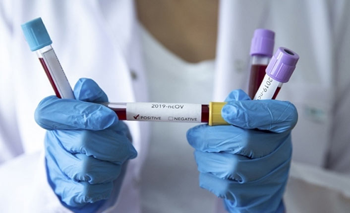 Türkiye'de 7 bin 489 kişinin Kovid-19 testi pozitif çıktı, 132 kişi hayatını kaybetti