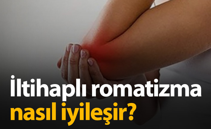 İltihaplı Romatizma Nasıl İyileşir? İltihaplı Romatizma belirtileri ve tedavisi