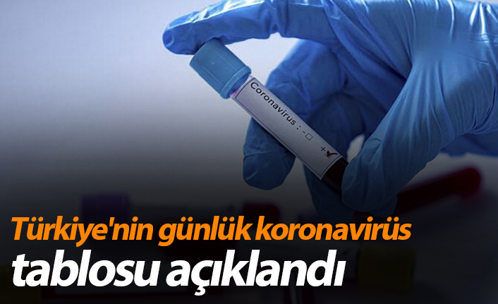 Türkiye'de son 24 saatte 6 bin 562 kişinin Kovid-19 testi pozitif çıktı, 128 kişi hayatını kaybetti