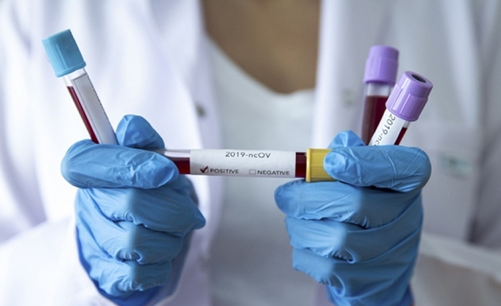 Türkiye’de 2 Şubat koronavirüs tablosu açıklandı: 7 bin 795 yeni vaka, 120 can kaybı