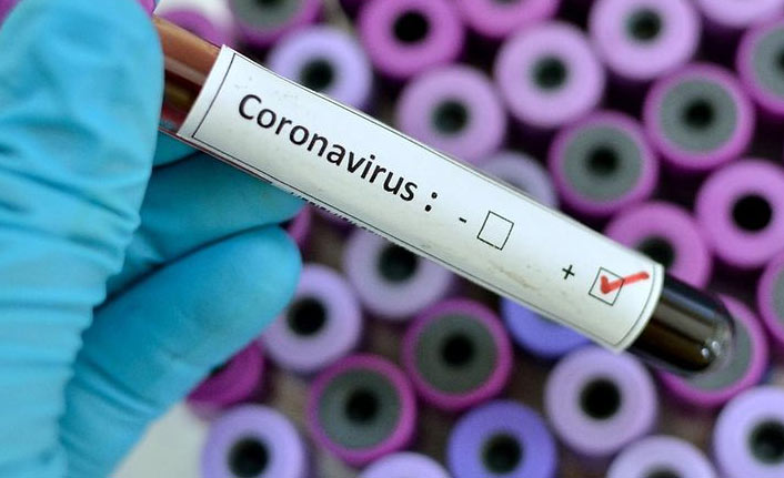 Türkiye'de 8 bin 103 kişinin Kovid-19 testi pozitif çıktı, 103 kişi hayatını kaybetti