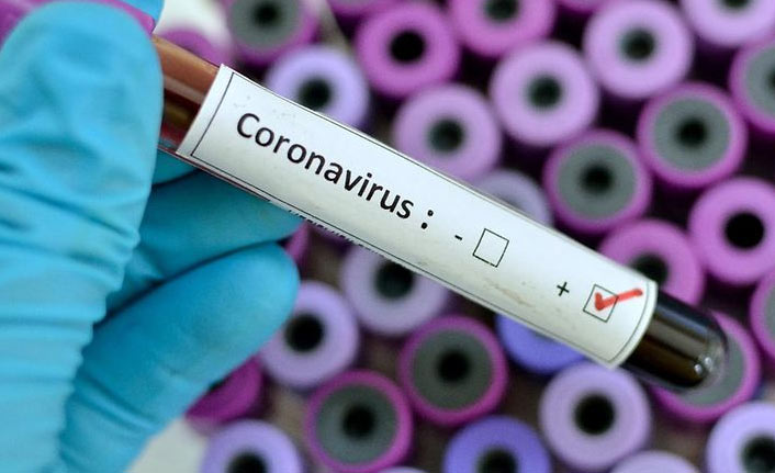 Son 24 saatte 8 bin 636 kişinin testi pozitif çıktı, 98 kişi hayatını kaybetti