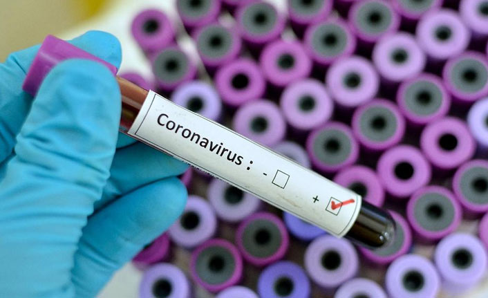 Türkiye'de 7 bin 763 kişinin Kovid-19 testi pozitif çıktı, 97 kişi hayatını kaybetti