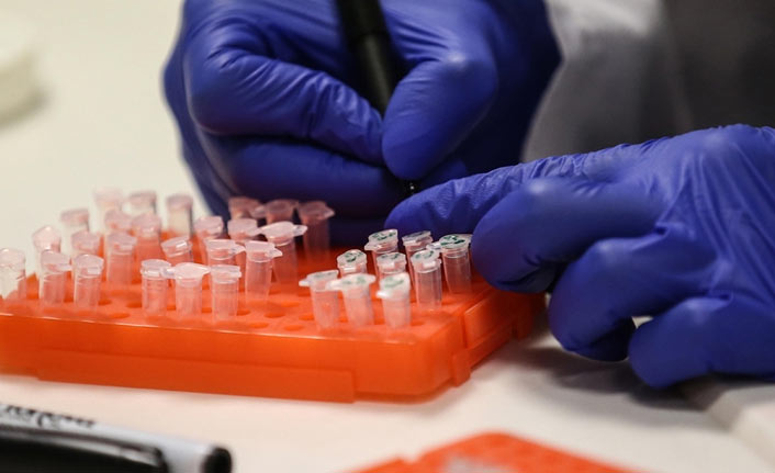 DSÖ: Kovid-19'un kökenine ilişkin tüm hipotezler hala masada