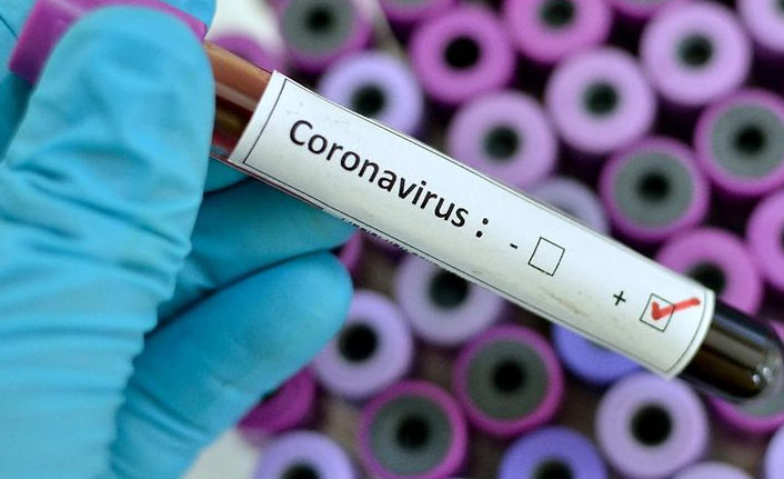 Türkiye'de son 24 saatte 7 bin 419 kişinin testi pozitif çıktı, 82 kişi hayatını kaybetti