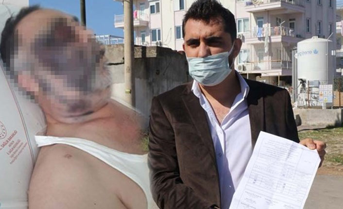 Yüzde 90 engelli adamı öldüresiye dövdüler