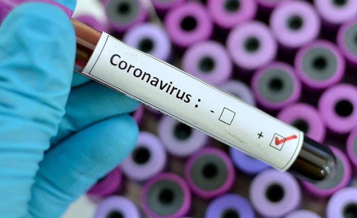 Türkiye’nin Günlük Koronavirüs Tablosu Açıklandı: 75 Kişi Hayatını Kaybetti