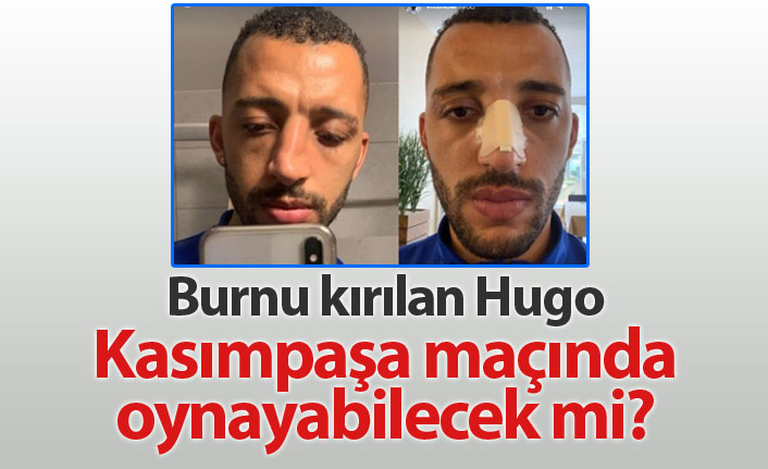 Burnu kırılan Vitor Hugo maça çıkabilecek mi?