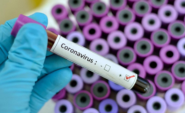 Türkiye'de 11 bin 837 kişinin Kovid-19 testi pozitif çıktı, 68 kişi hayatını kaybetti