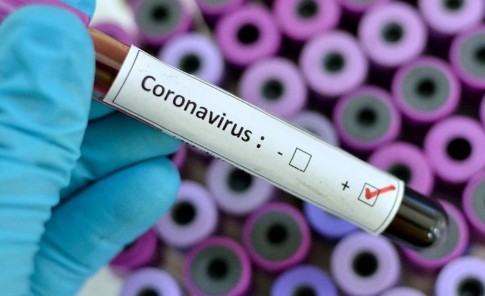 Türkiye'de 11 bin 302 kişinin Kovid-19 testi pozitif çıktı, 62 kişi hayatını kaybetti