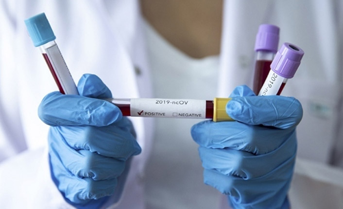 Türkiye'de günlük Kovid-19 vaka sayısı yeniden 20 bini aştı