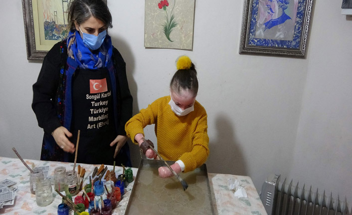 Kelebek hastası Trabzonlu Ayşenur ebru sanatına tutundu