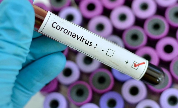 Türkiye'de 21 bin 61 kişinin Kovid-19 testi pozitif çıktı, 95 kişi hayatını kaybetti