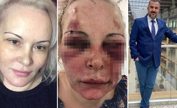 Türk sevgili Rus kadına cehennemi yaşattı!