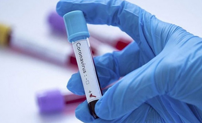 Türkiye’de 29 bin 762 yeni vaka, 146 kişi yaşamını yitirdi