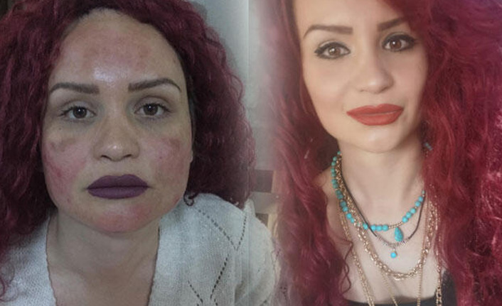 Bir kez denedi hayatı mahfoldu