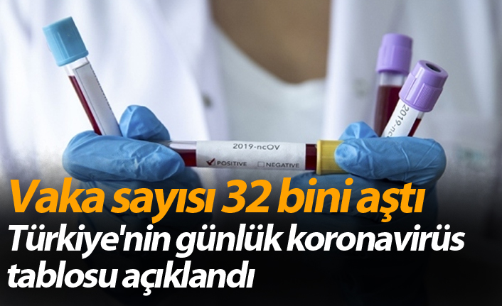 Türkiye’de 32 bin 404 yeni vaka, 154 kişi yaşamını yitirdi
