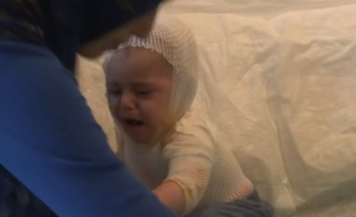 1 yaşındaki çocuğun üzerine kaynar süt döküldü!