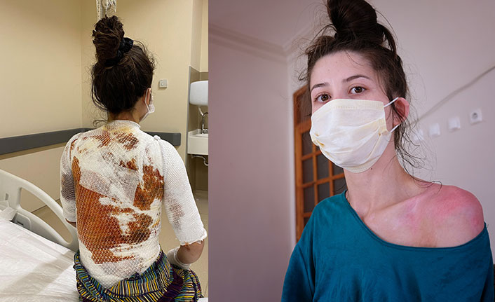 Eşini ve 1,5 yaşındaki kızını kaynar suyla haşladı, senaryo dedi!