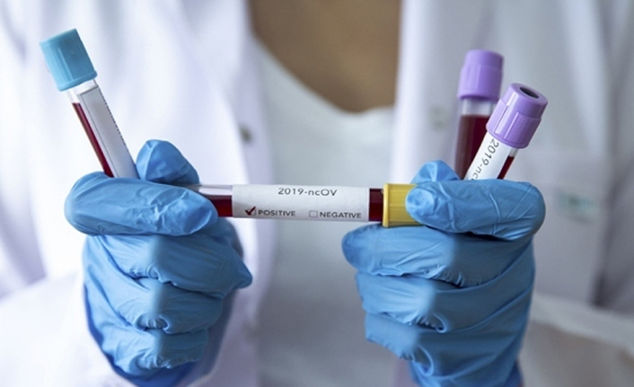 Türkiye’de 42 bin 308 yeni vaka, 179 kişi yaşamını yitirdi