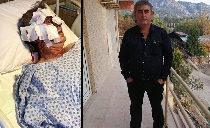 Kafesinden kaçan maymun otel personeline saldırdı