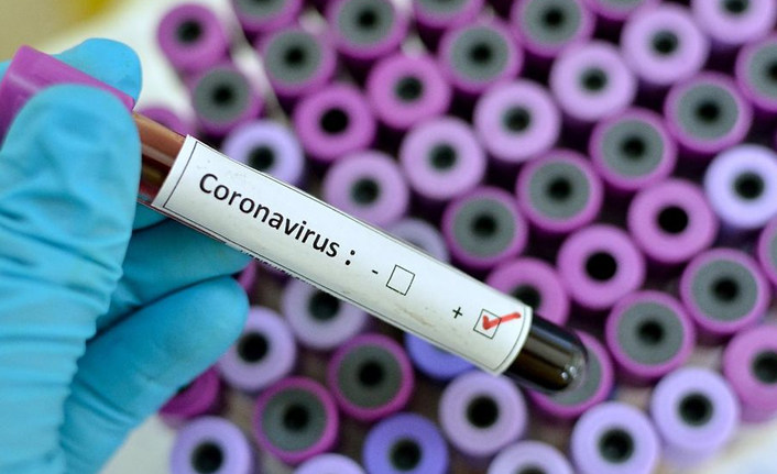 Türkiye’de 55 bin 941 yeni vaka, 258 can kaybı