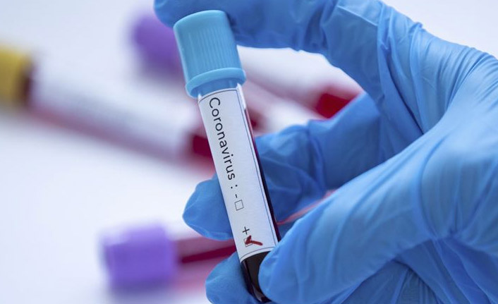 Türk bilim insanı umutlandıran çalışma! Koronavirüsü 48 saatte yok edecek