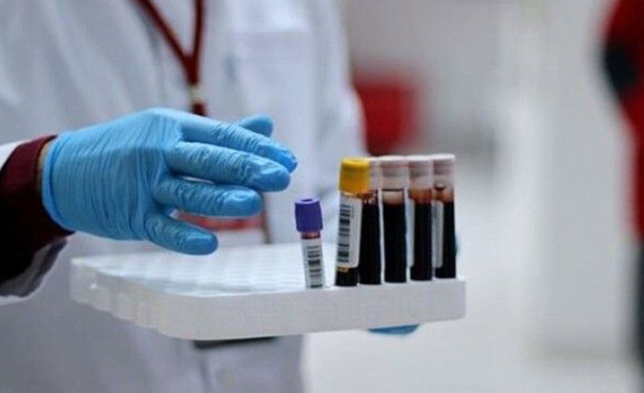 İtalya'da bir günlük bilanço ağır