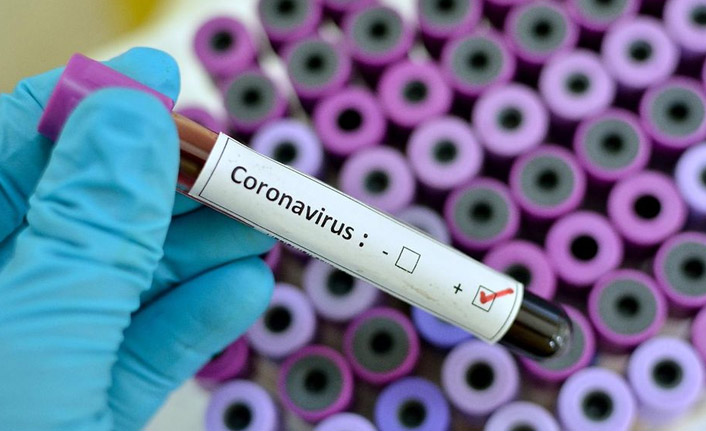 Türkiye’de 61 bin 967 yeni vaka, 362 kişi hayatını kaybetti