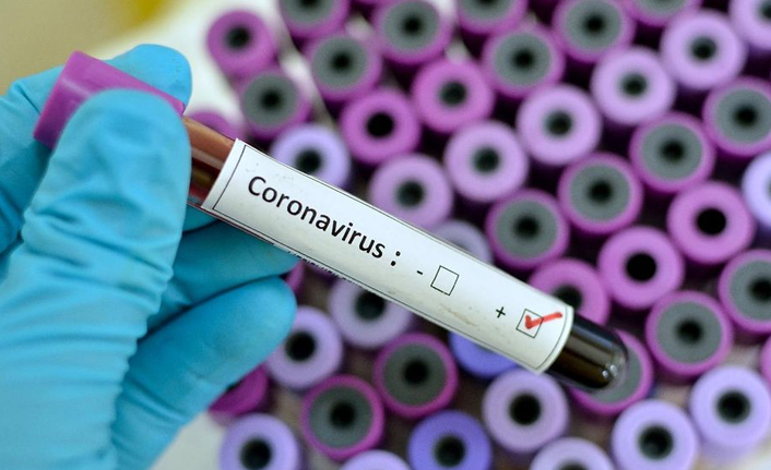 Türkiye’de 20 bin 107 yeni vaka, 278 kişi yaşamını yitirdi