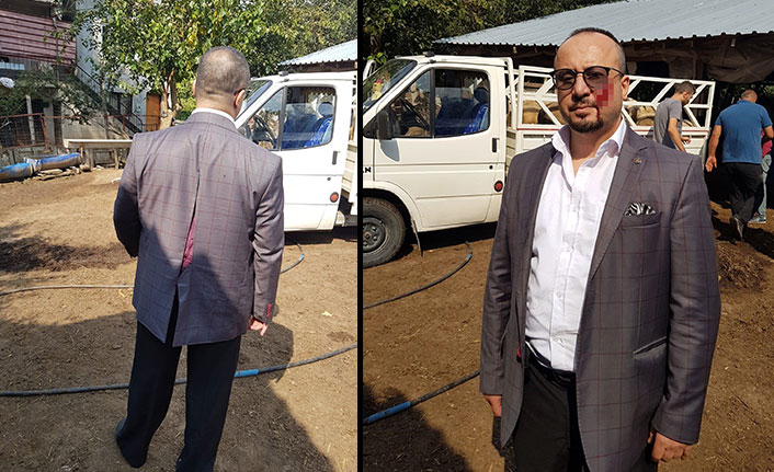 Haciz için gelen avukatın yanağını ısırdı