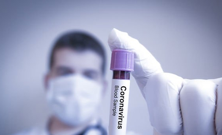 Türkiye’de Günlük Koronavirüs Tablosu: 238 Kişi Hayatını Kaybetti