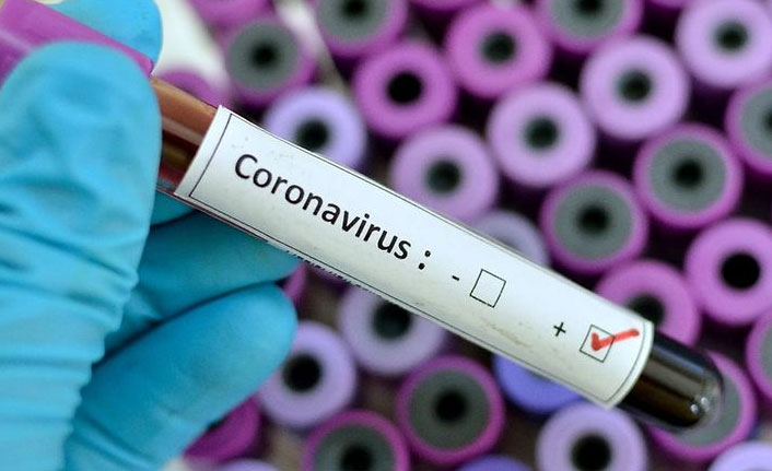 Türkiye'de 10 bin 174 kişinin Kovid-19 testi pozitif çıktı, 223 kişi yaşamını yitirdi