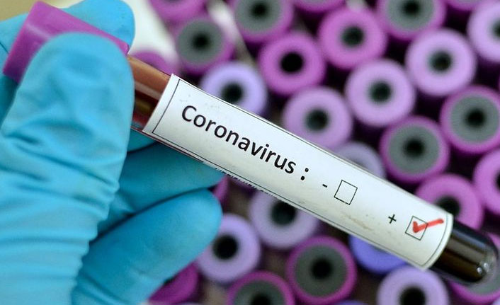 Türkiye'de 8 bin 738 kişinin Kovid-19 testi pozitif çıktı