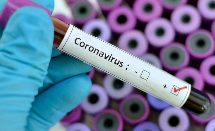 Türkiye'de 7 bin 656 kişinin Kovid-19 testi pozitif çıktı, 137 kişi yaşamını yitirdi