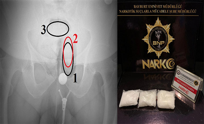 Bayburt'ta uyuşturucu satıcılarının zula yöntemi pes dedirtti